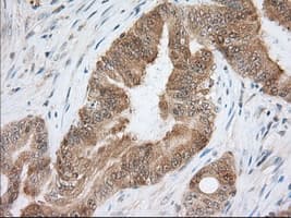 ACAT2 Antibody (clone OTI5A2)