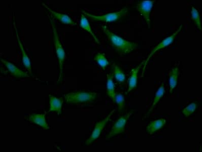 BBS7 Antibody