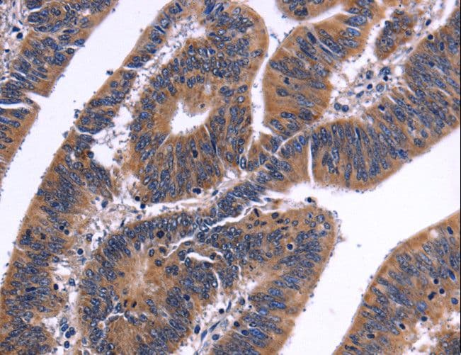 NFAT4 / NFATC3 Antibody