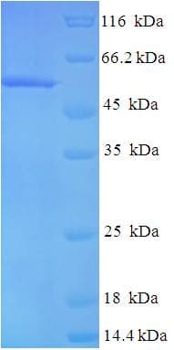 Human RMDN3 Protein (Recombinant His)