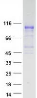 Human FGFR1 / FGF Receptor 1 Protein (Recombinant Myc-DDK (Flag))