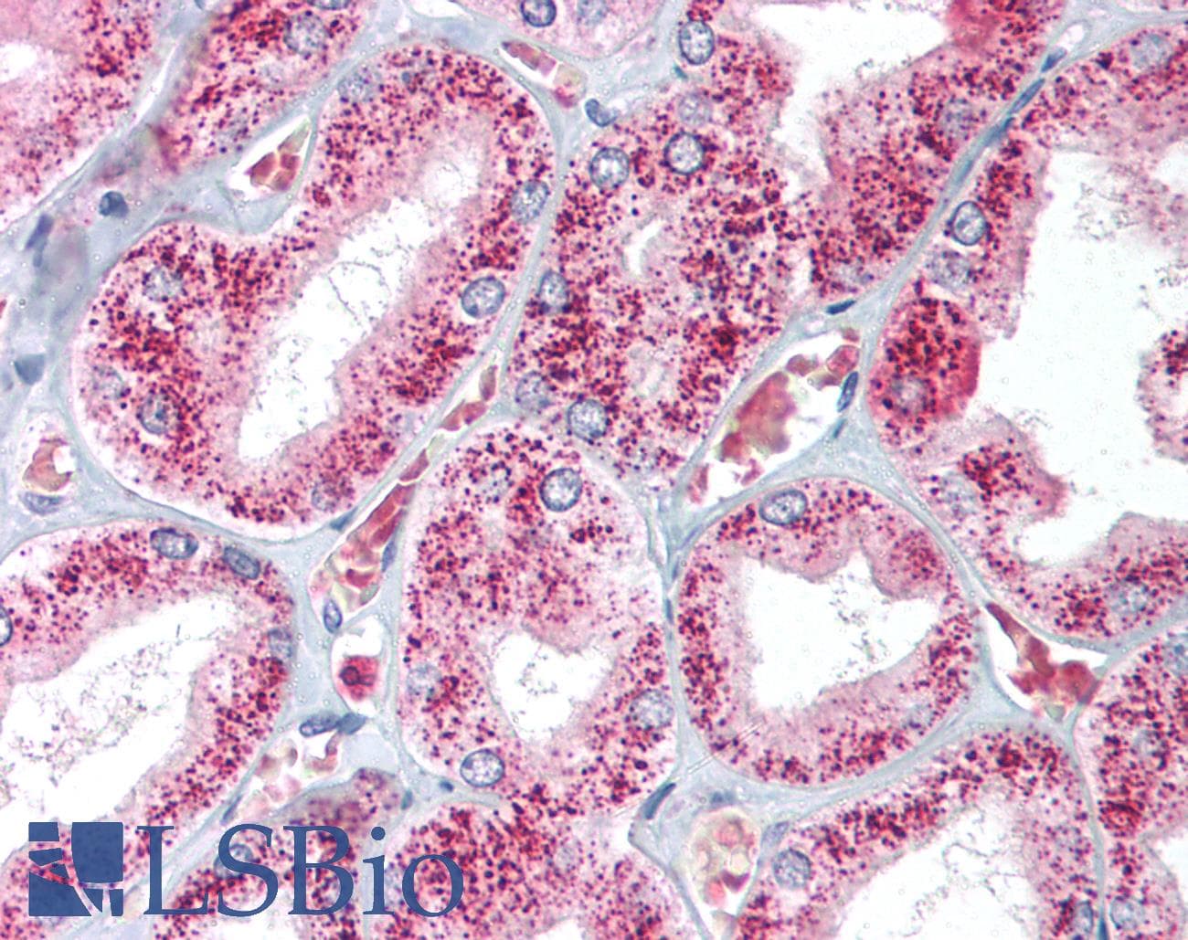 IHC-plus™ Polyclonal Rabbit anti-Bovine CAT / Catalase Antibody (IHC, WB)