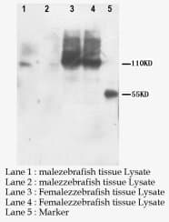 PNPLA6 / NTE Antibody (C-Terminus, Sepharose)