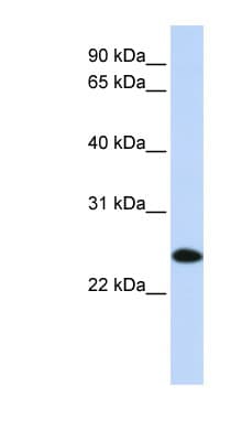 UBE2K / LIG Antibody (aa36-85)