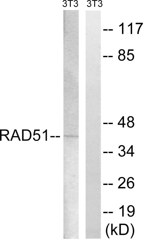 RAD51 / RECA Antibody (aa275-324)