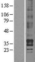 LPAR2 / EDG4 Protein (Over-Expression Lysate Myc-DDK (Flag))