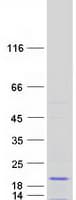 Human LECT2 Protein (Recombinant Myc-DDK (Flag))
