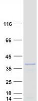Human NABP2 Protein (Recombinant Myc-DDK (Flag))