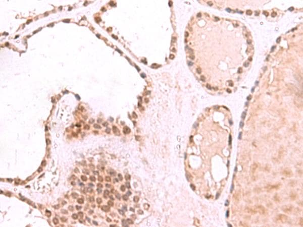 TIP49 / RUVBL1 Antibody