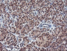 PPP1R15A / GADD34 Antibody (clone OTI3D12)