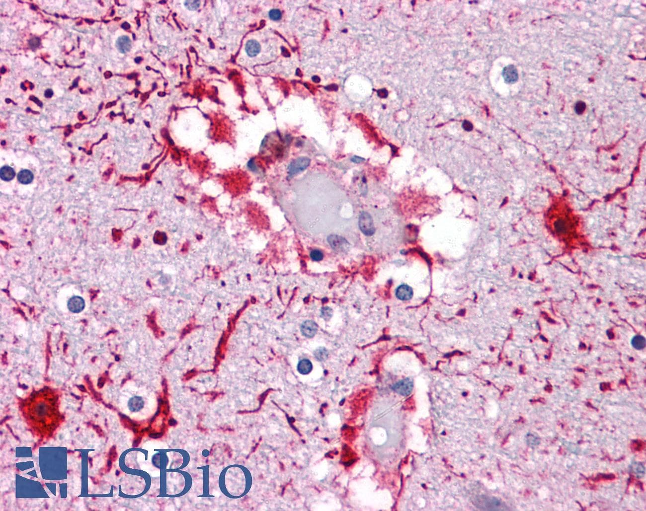 IHC-plus™ Polyclonal Rabbit anti-Human PIWIL2 Antibody (IHC)
