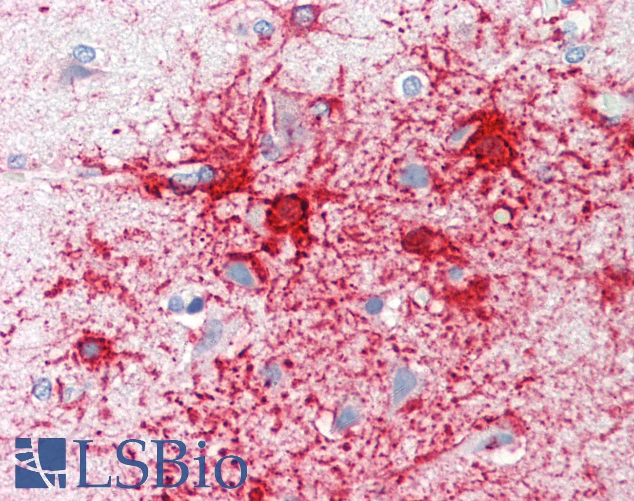 IHC-plus™ Polyclonal Rabbit anti-Human ADCY1 / Adenylate Cyclase 1 Antibody (aa231-280, IHC, WB)