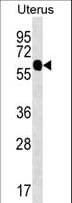 ZFP64 Antibody (aa525-551)