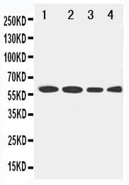 Polyclonal Rabbit anti-Human LCAT Antibody (aa300-313, WB)