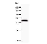 HOXC11 Antibody (clone HOX5J232)