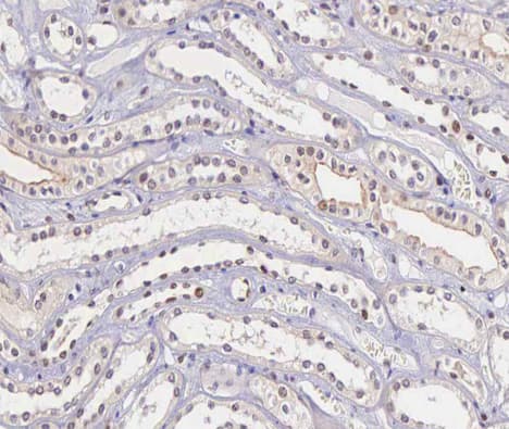 Polyclonal Rabbit anti-Human TIMP4 Antibody (IHC, IF, WB)