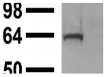 ASIC1 / ACCN2 Antibody (clone S271-44)