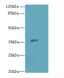 SLC35B1 / UGTREL1 Antibody