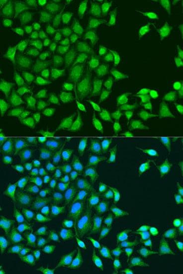 TIP49 / RUVBL1 Antibody