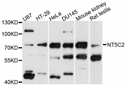 Polyclonal Rabbit anti-Human NT5C2 Antibody (WB)
