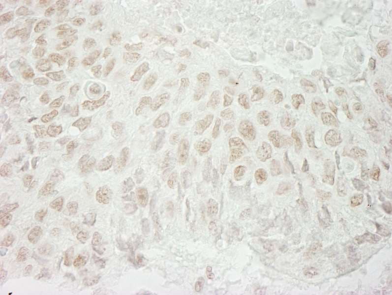 Polyclonal Rabbit anti-Human USP37 Antibody (aa125-175, IHC)