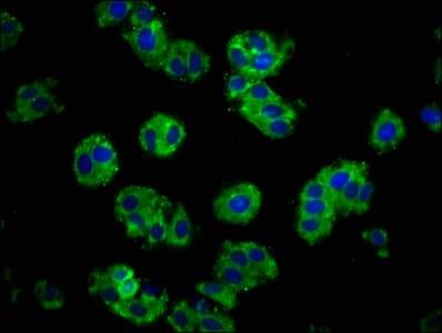 PathPlus™ Polyclonal Rabbit anti-Human CDH1 / E Cadherin Antibody (IHC)