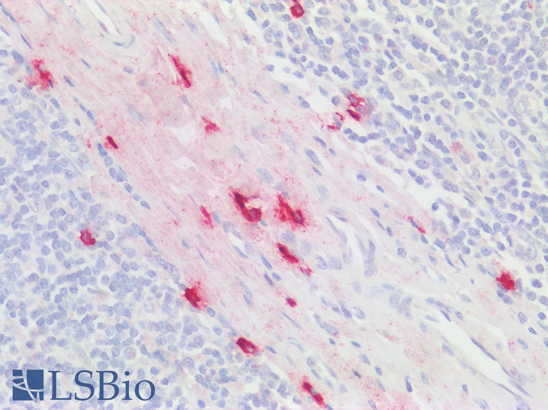 IHC-plus™ CMA1 / Mast Cell Chymase Antibody (aa96-110)
