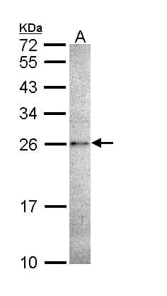 Polyclonal Rabbit anti-Human CASP14 / Caspase 14 Antibody (IF, WB)