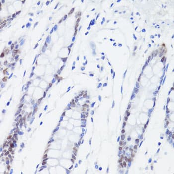 Polyclonal Rabbit anti-Human ESRRA / ERR Alpha Antibody (IHC, WB)