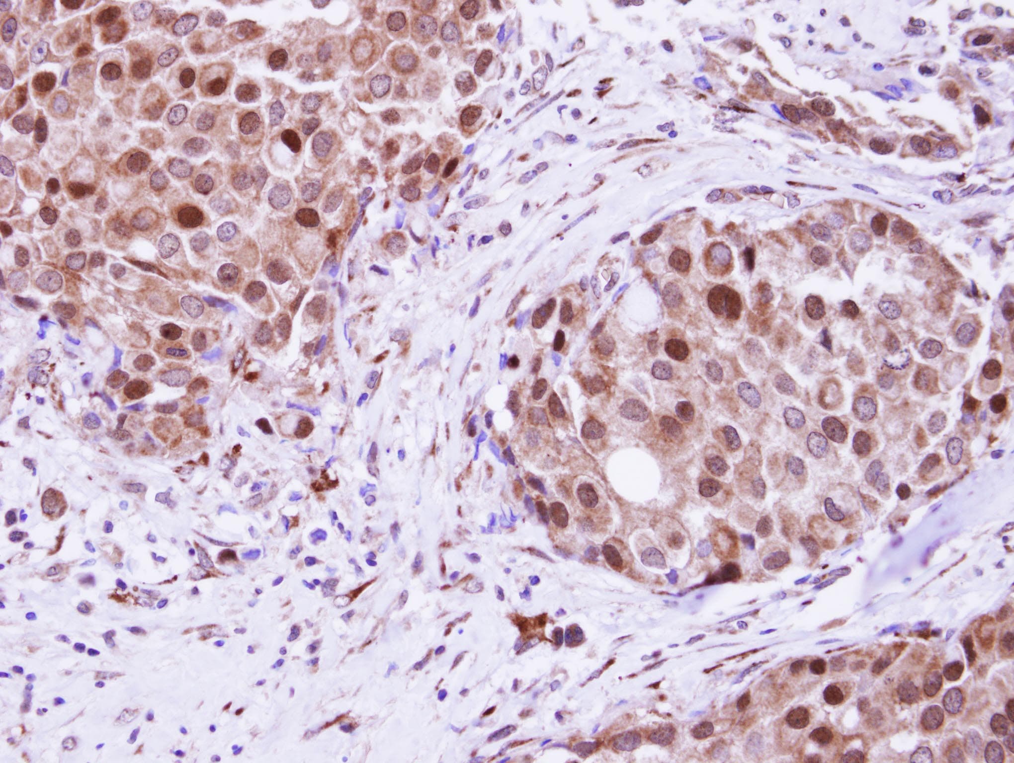 Polyclonal Rabbit anti-Human RAD23B / HR23B Antibody (IHC, IF, WB)