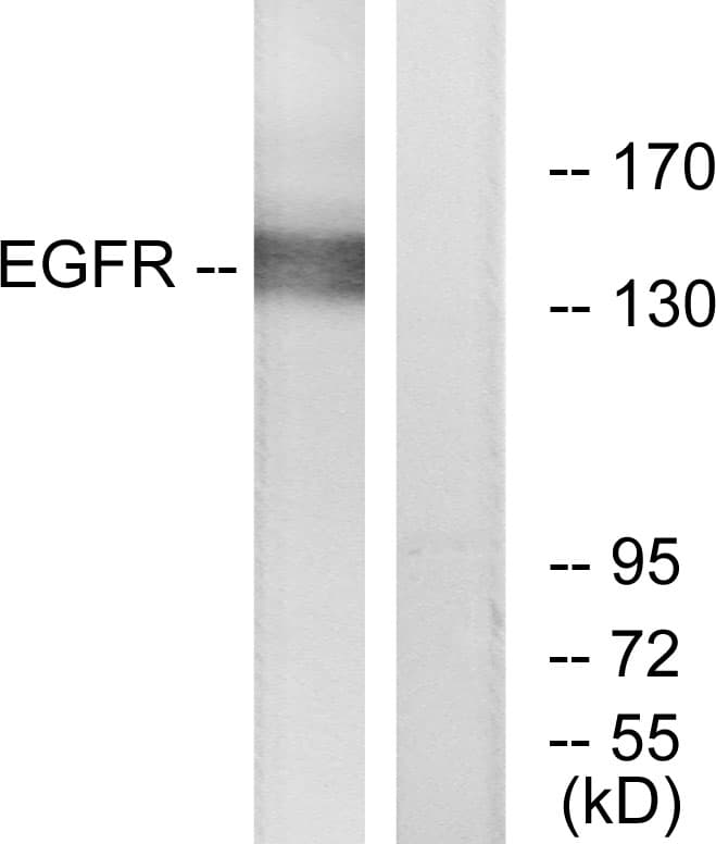 EGFR Antibody (aa836-885)