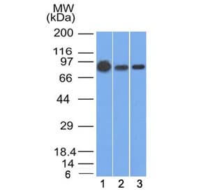 Monoclonal Mouse anti-Human CTNNB1 / Beta Catenin Antibody (clone 9F2, IF, WB)