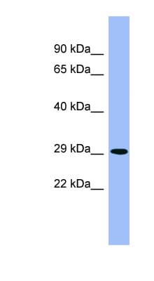 RD / PHYH Antibody (aa251-300)