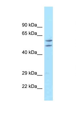 Polyclonal Rabbit anti-Human ATG16L1 / ATG16L Antibody (aa215-264, WB)