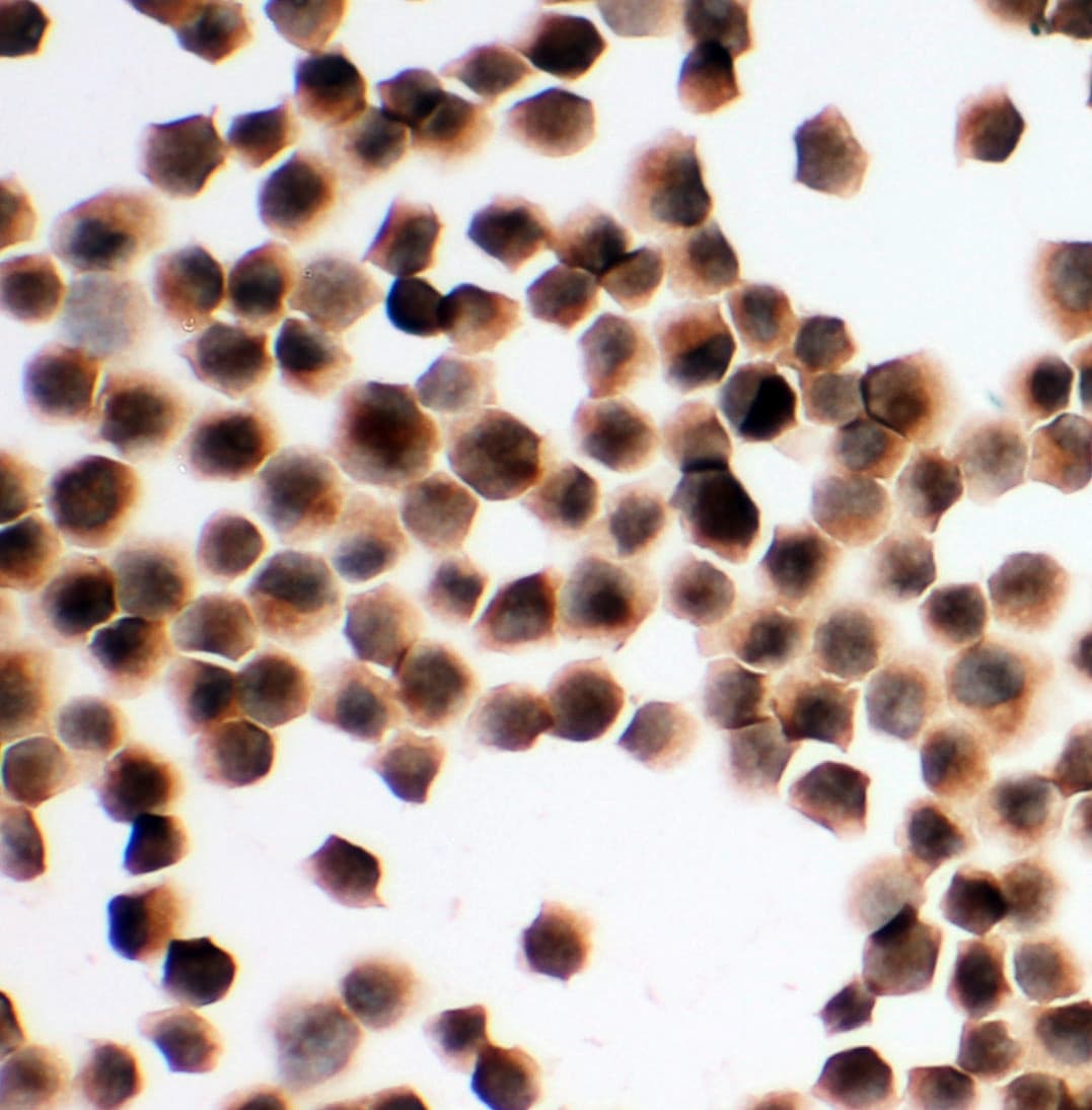 HAVCR1 / KIM-1 Antibody (aa332-348)