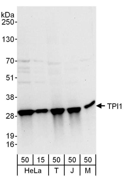 IHC-plus™ Polyclonal Rabbit anti-Human TPI1 / TPI Antibody (aa199-249, IHC, WB)