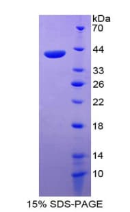 Human CCL22 / MDC Protein (Recombinant His-GST)