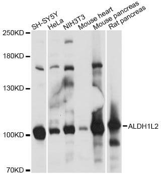 Polyclonal Rabbit anti-Human ALDH1L2 Antibody (WB)