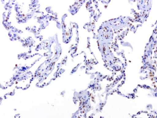 ERCC1 Antibody (clone 4F9, Carrier-free)