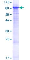Human PRKCZ / PKC-Zeta Protein (Recombinant GST)