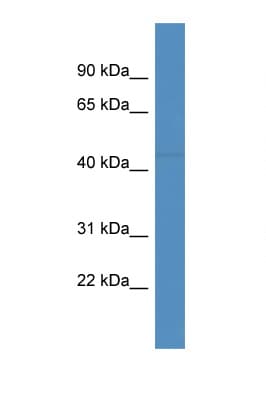FBXL20 Antibody (aa176-225)