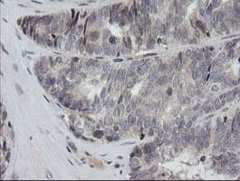 RAB30 Antibody (clone OTI1B2)