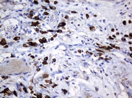 SRPRB Antibody (clone OTI2D7)