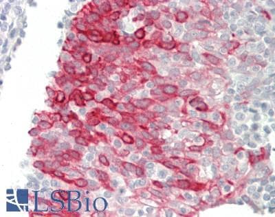 IHC-plus™ KRT19 / CK19 / Cytokeratin 19 Antibody (aa240-390, clone 8H7)