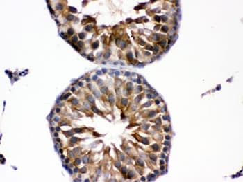 EDNRB / Endothelin B Receptor Antibody