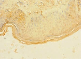 ASPHD1 Antibody