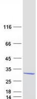 Human SARA2 / SAR1B Protein (Recombinant Myc-DDK (Flag))