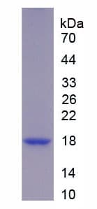 Human UCN3 / SPC Protein (Recombinant His)
