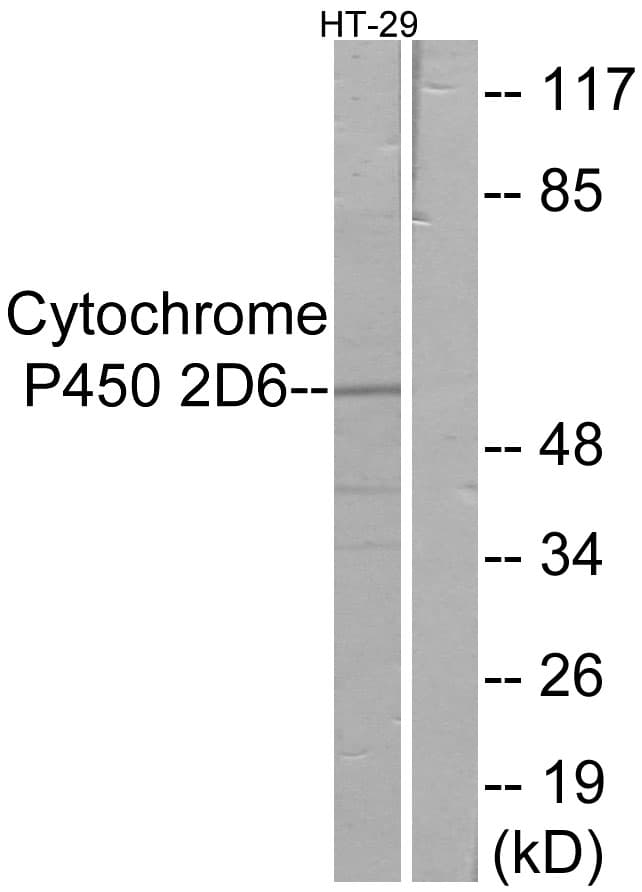 CYP2D6 Antibody (aa251-300)