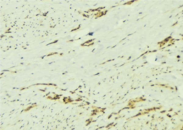 PTPN2 / TC-PTP Antibody